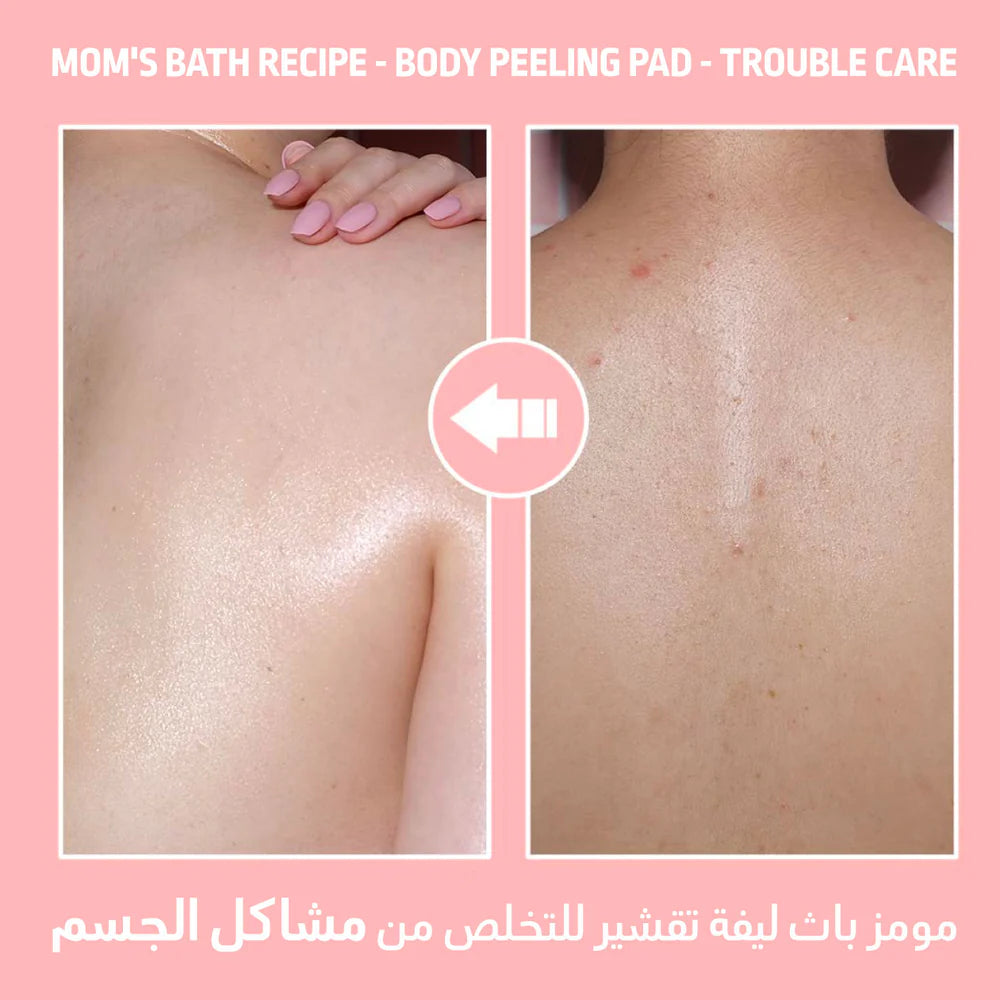 Mom’s Bath Recipe Body Peeling Pad Trouble Care (1 Pcs) - 25ml