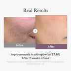 Medicube AGE-R Glutathione Glow Capsule Cream - 50ML