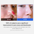 Medicube Zero Pore Pad - 155g (70 Pads)