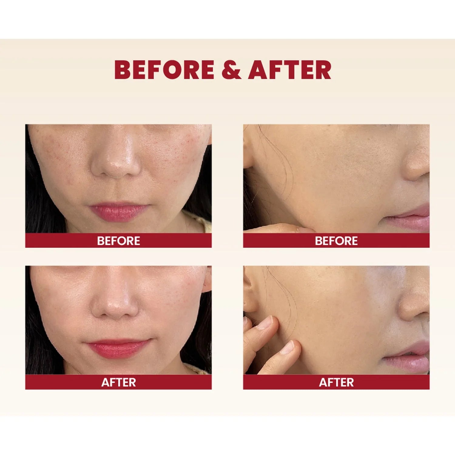SEOUL 1988 Cream : Snail Mucin 93% + Rice
